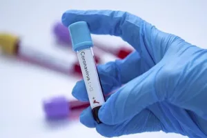 Ενημέρωση: Θάνατοι στην Κύπρο από Covid - 587 και όχι 577