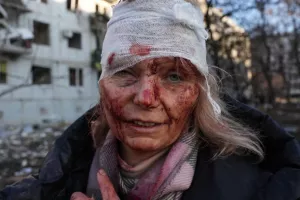 Αιματηρές εικόνες από την Ουκρανία... 