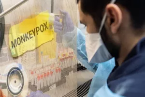 Κύπρος/Ευλογιά πιθήκων: Πάμε ξανά με πρωτόκολλα, τεστ και εμβόλια