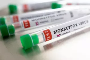 Έτοιμο για περιστατικά ευλογιάς των πιθήκων το Υπ. Υγείας