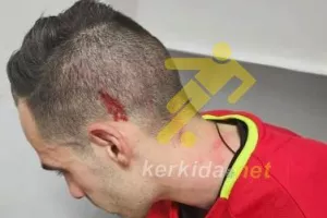 Σοβαρές καταγγελίες για ξυλοδαρμό απ' τον ρεφ του Άχνα - Π.Ο Αχυρώνα Ονήσιλου