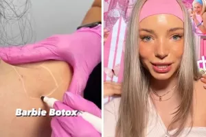 Barbie Botox, η νέα τάση που σαρώνει στο TikTok