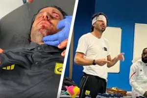 "Παραδειγματική τιμωρία στη Μαρσέιγ για την επίθεση με πέτρες στη Λυών"