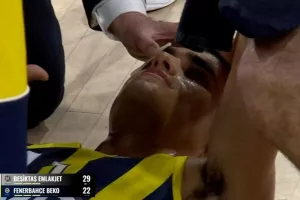 «Μερική απώλεια όρασης ο Μαντάρ από το κέρμα»