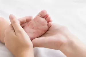 Βρετανία: Αντιμέτωπη με έξαρση ιλαράς - 198 επιβεβαιωμένα κρούσματα το τελευταίο τρίμηνο
