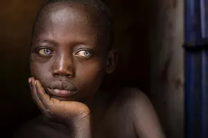 Σουδάν: Η UNICEF προειδοποιεί ότι 700.000 παιδιά κινδυνεύουν από τη χειρότερη μορφή υποσιτισμού