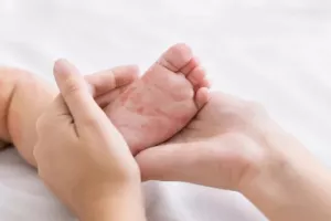 Παγκόσμια ανησυχία για την εξάπλωση της ιλαράς - Φόβοι για επιδημία και στην Ελλάδα!