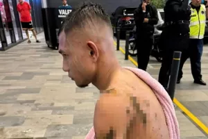 Στην εντατική Μαλαισιανός διεθνής ποδοσφαιριστής μετά από επίθεση με καυστικό οξύ!