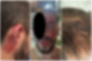 Σοβαρό επεισόδιο με τραυματισμό οπαδού του ΑΠΟΕΛ (Πληροφορίες Offsite)