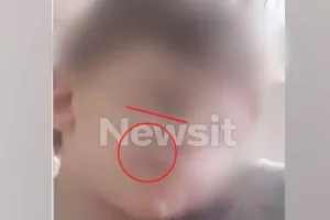 Ανέβαζε βίντεο στο Tiktok με τα σημάδια της κακοποίησης στο προσωπάκι του τρίχρονου Άγγελου
