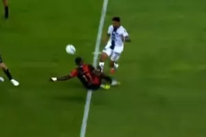 Τρόμαξε κόσμο με τη φωτογραφία που ανέβασε μετά τον τραυματισμό του στο πόδι